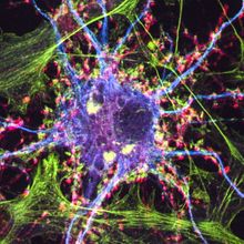 Nerve cell labelled with different colours