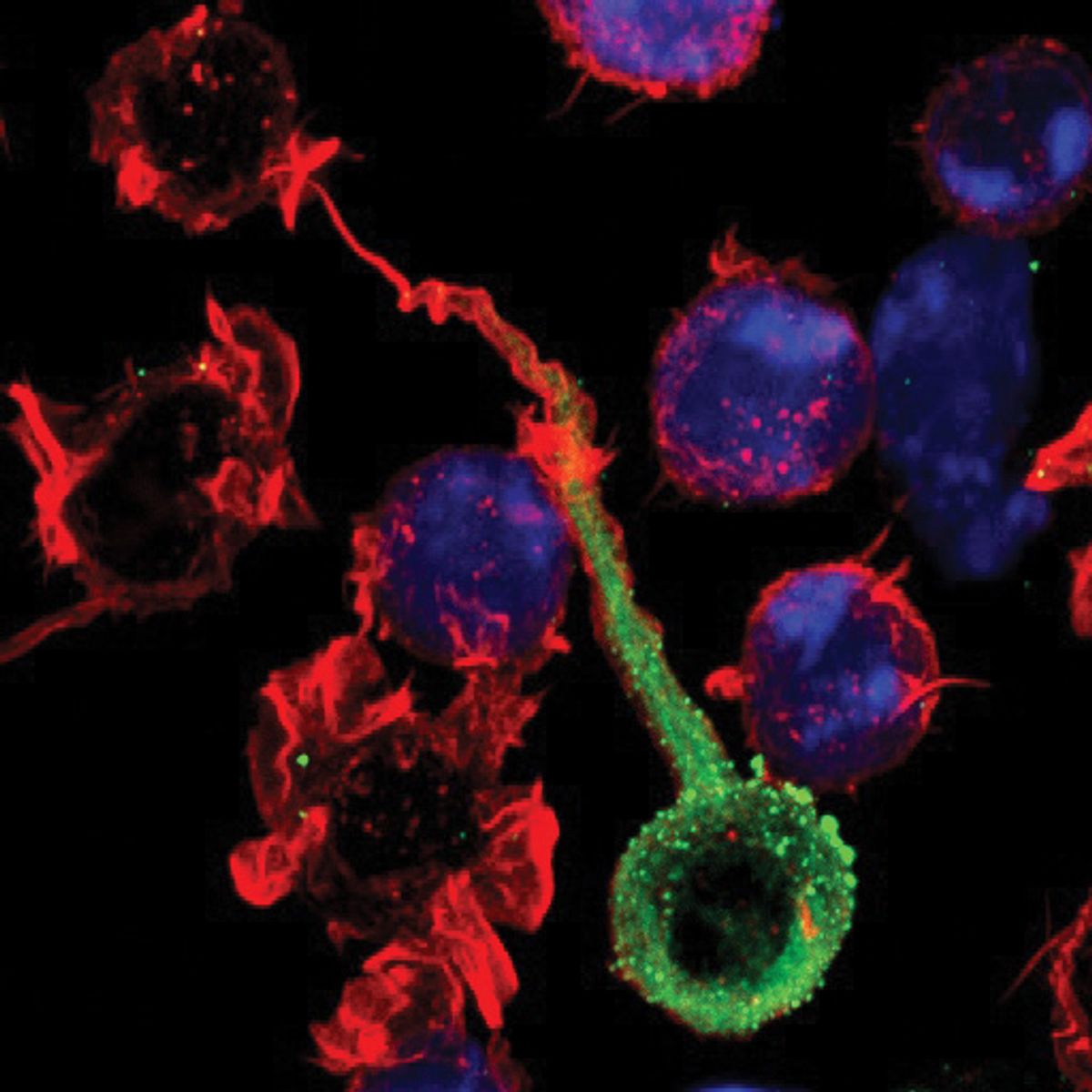 Immune cells are labeled with a red marker. HIV particles (green) from an infected cell are transferred to an uninfected cell via direct cell-to-cell contact.