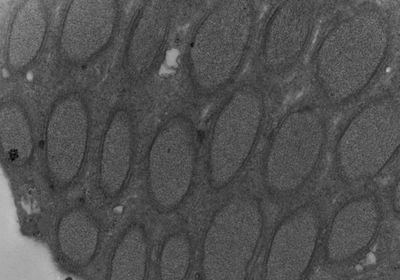 Electron Micrograph of Wolbachia in testes of the wasp Nasonia vitripennis.