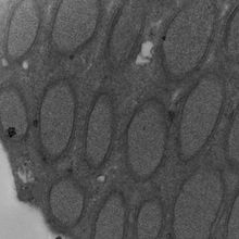 Electron Micrograph of Wolbachia in testes of the wasp Nasonia vitripennis.