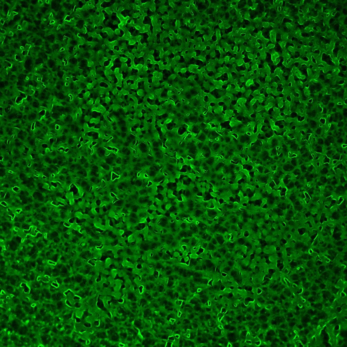 An image of a fluorescent protein from tick saliva forming a lattice structure.