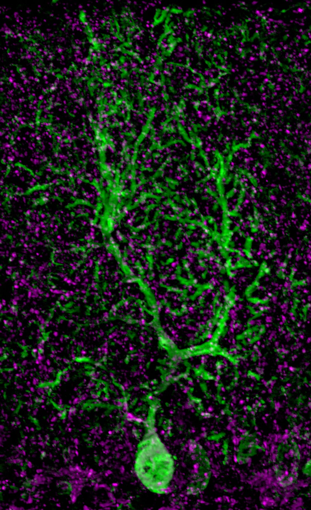 Fluorescent image of a highly branched Purkinje cell (green) surrounded by its neurotransmitter transporter (magenta). 