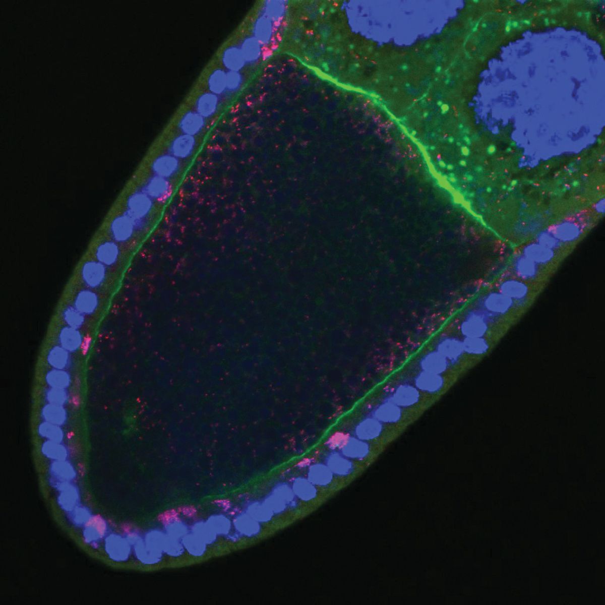 The image shows a fruit fly oocyte infected with Wolbachia bacteria.