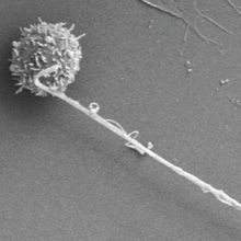 Scanning electron micrograph showing cancer cell attached to T call via nanotube