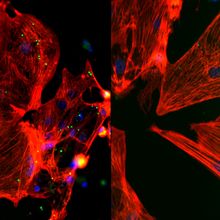 Fluorescent images of red cells showing high and low levels of infection in green