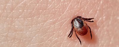 A tick embedded into skin.