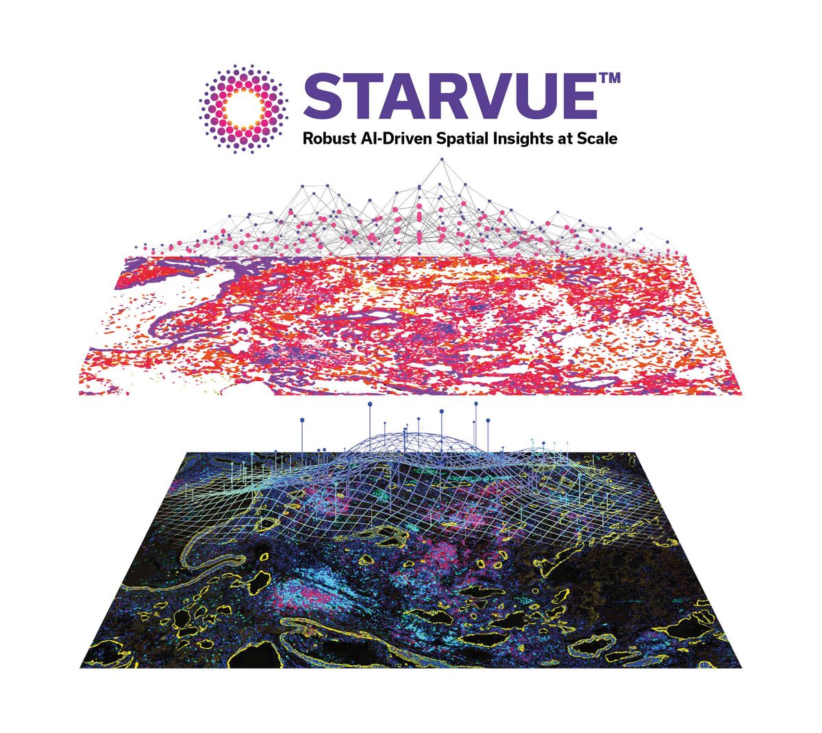 Image representing how the STARVUE program analyzes stained tissue