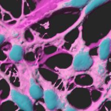 Fluorescent cells in culture connected by tunneling nanotubules