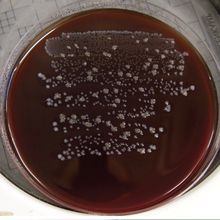 a vial of cobra venom and a bacteri-covered agar plate