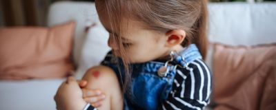 A young child holding her bruised knee.