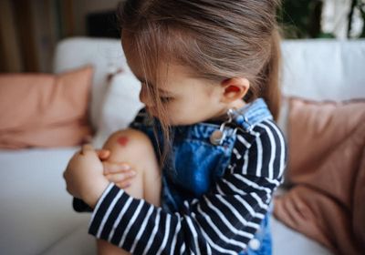 A young child holding her bruised knee.