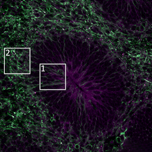 Histology showing IL-6 expression