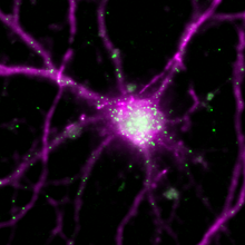 Brain cell in purple on a black background. Arc mRNAs are labeled green and are mainly localized in the cell nucleus and in the dendrites.