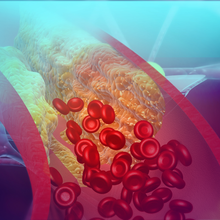 An illustration shows circular red blood cells running into a yellow cholesterol blockage in a transverse section of an artery on a blue and purple background