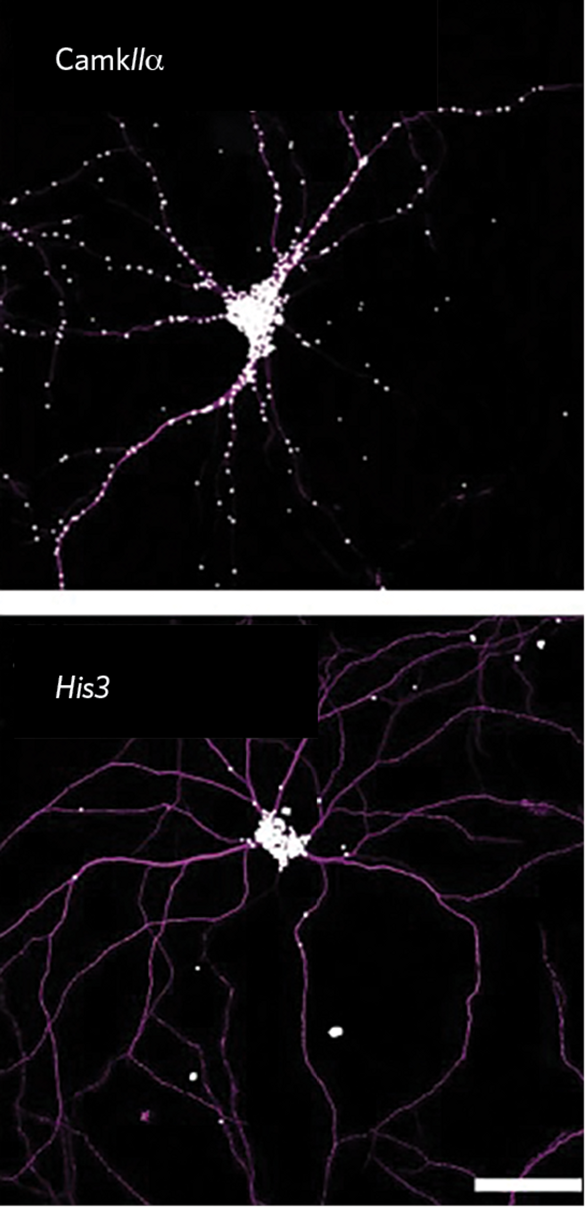 Neurons labeled in pink on a black background. White dots depict the expression patterns of two mRNAs throughout the neurons.