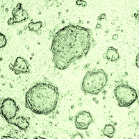 esc embryonic stem cell fetal tissue