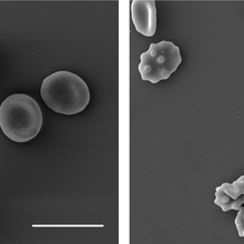 Red blood cells are pictured in grayscale on a gray background