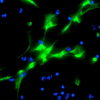 neutrophil extracellular traps NETs coronavirus covid-19 pandemic sars-cov-2 innate immune response immunity pathogen elastase chromatin DNA