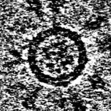 SARS-CoV-2 self-assembling virus-like nanoparticle with spike proteins protruding from the surface.